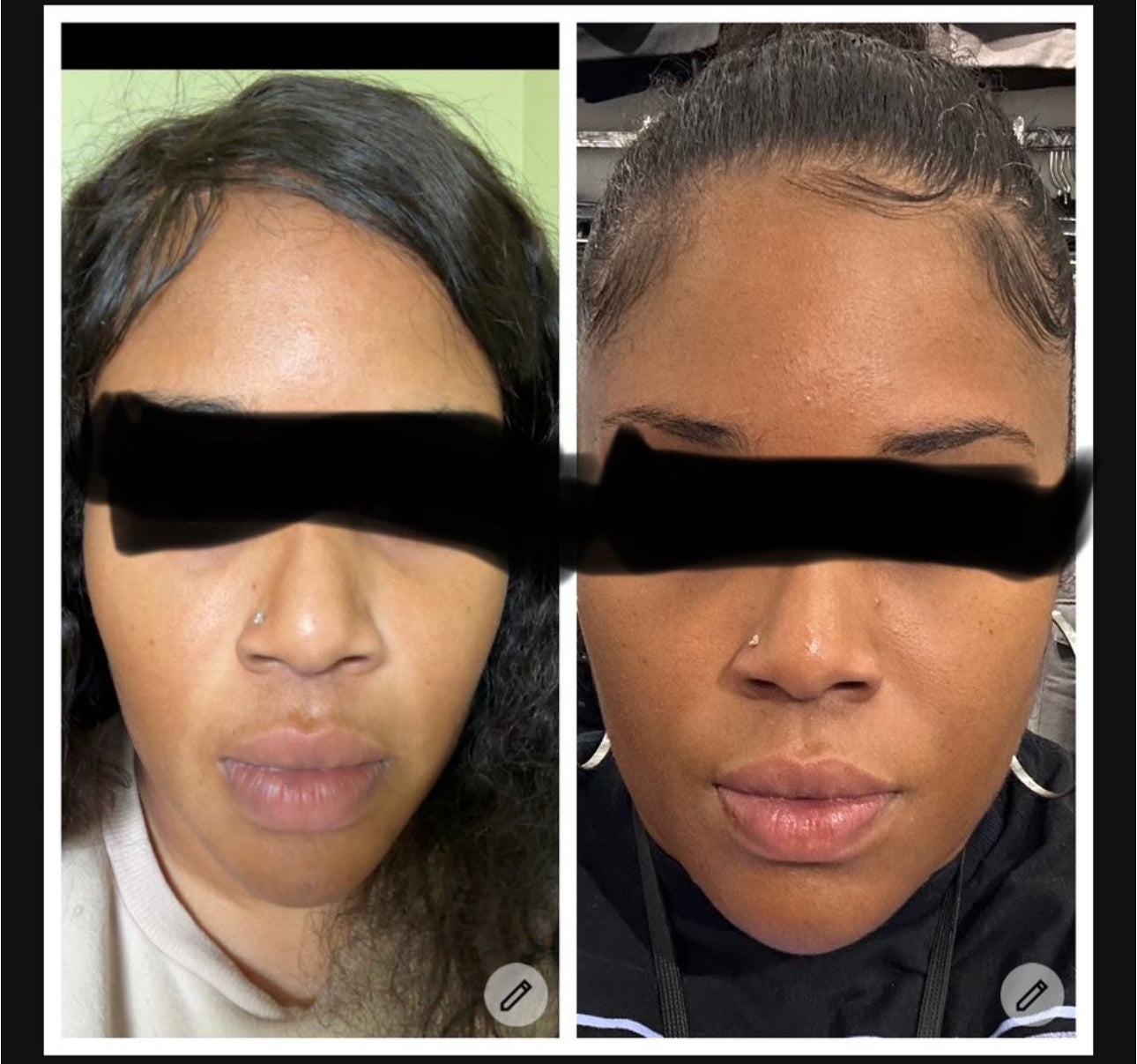 Winter doll Whitening face cream